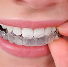 Ortodoncia Invisalign
