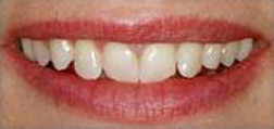 Cosmetic Dentist Near Lakeview