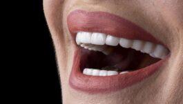 A beautiful, healthy smile with porcelain veneers
