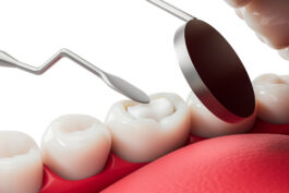 Dental filling with a close-up of tools working on a molar